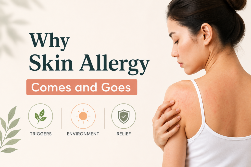 Why Skin Allergy Comes and Goes: Causes, Triggers and Long Term Relief